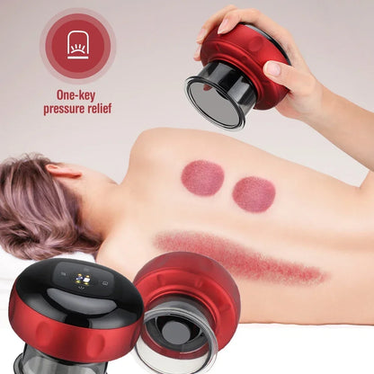 Smart Electric Cupping Therapy Massager – Heated Suction Cup for Deep Tissue Relief & Muscle Recovery